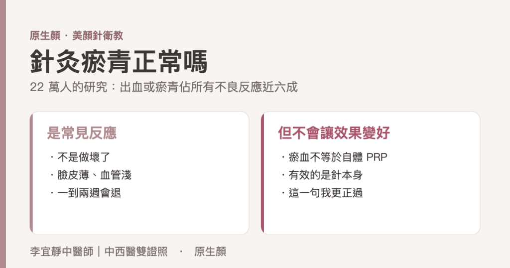 針灸瘀青正常嗎：22萬人研究中出血或瘀青佔所有不良反應近六成，但瘀青不會讓效果變好